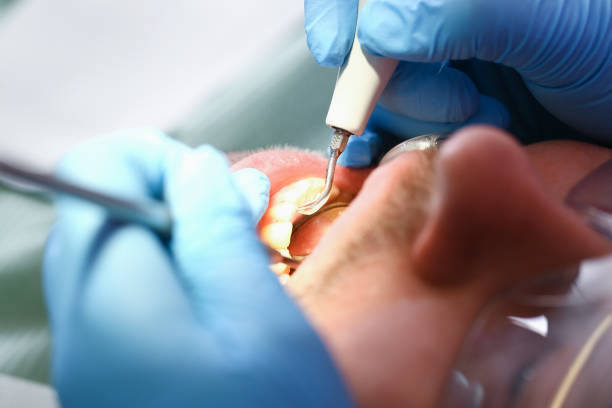 Best Urgent Care for Lost Fillings or Crowns in Meadows Place, TX