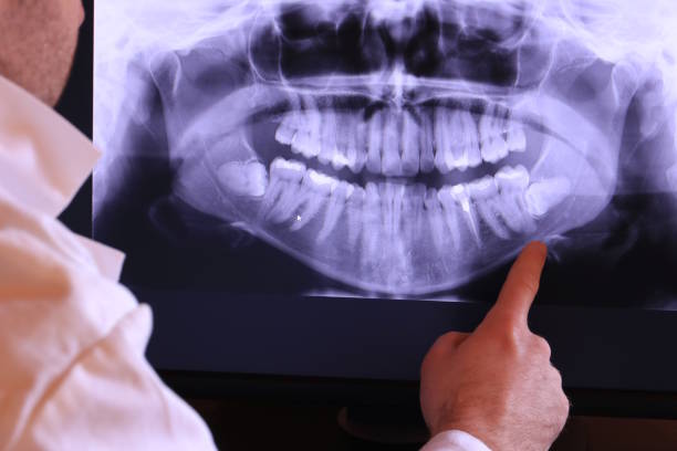 Best Emergency Gum Treatment in Meadows Place, TX