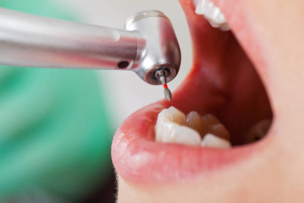 Best Pediatric Emergency Dentist in Meadows Place, TX
